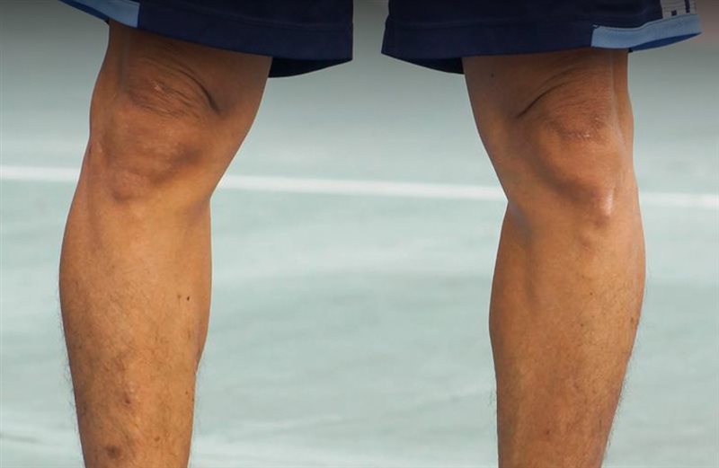 دستگاه پا پرانتزی