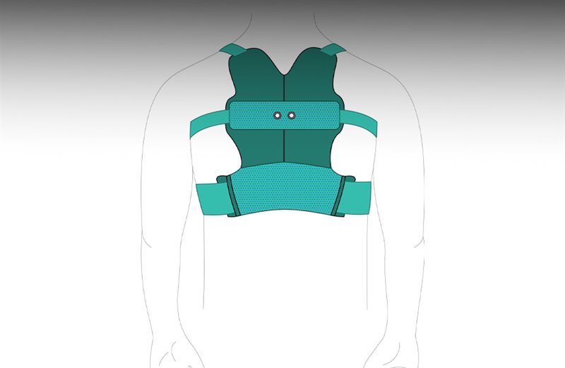 دستگاه کیفوز